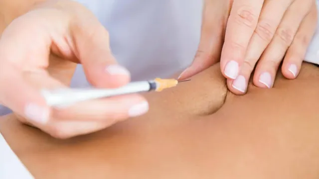 Behandlungssituation der Injektionslipolyse