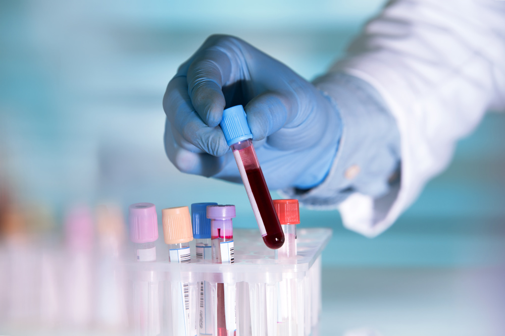 Blutanalyse im Labor, Blutprobe im Reagenzglas